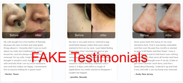 Fake Remedy Skin Tag Remover Customer Reviews