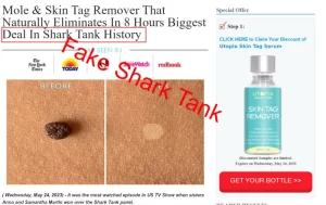 Utopia Skin Tag Remover Shark Tank fake page