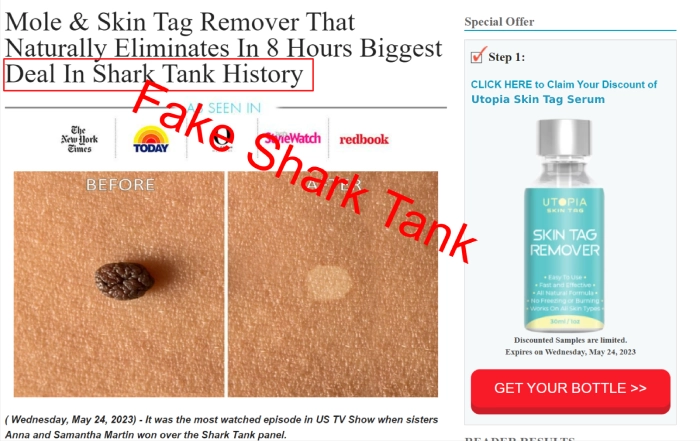 Utopia Skin Tag Remover Shark Tank fake page