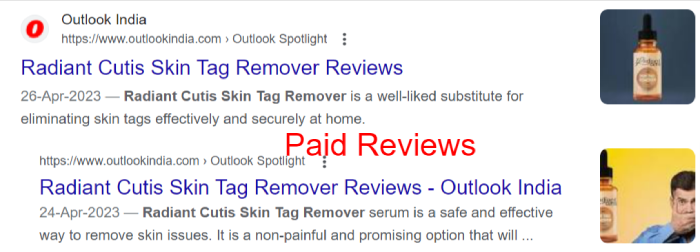 Paid Radiant Cutis Skin Tag Remover Reviews