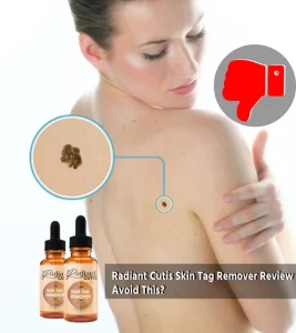 Radiant Cutis Skin Tag Remover Reviews